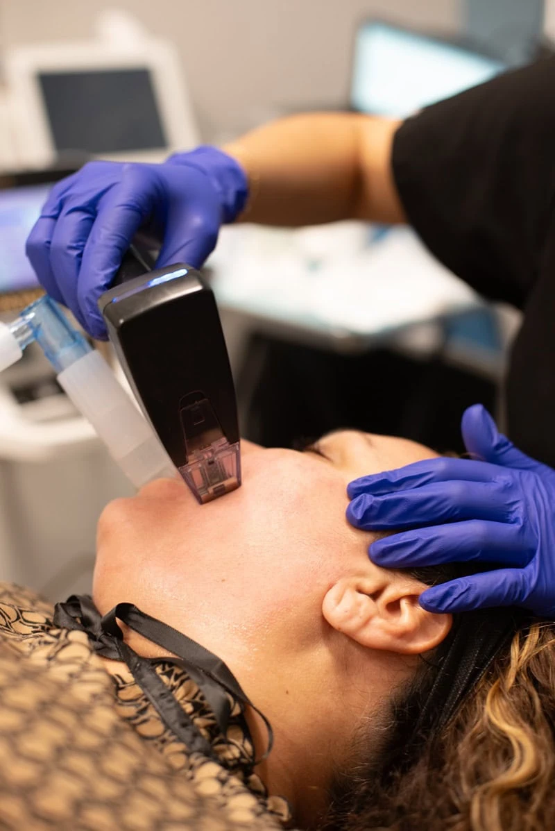 How Long Is the Recovery After Morpheus8?