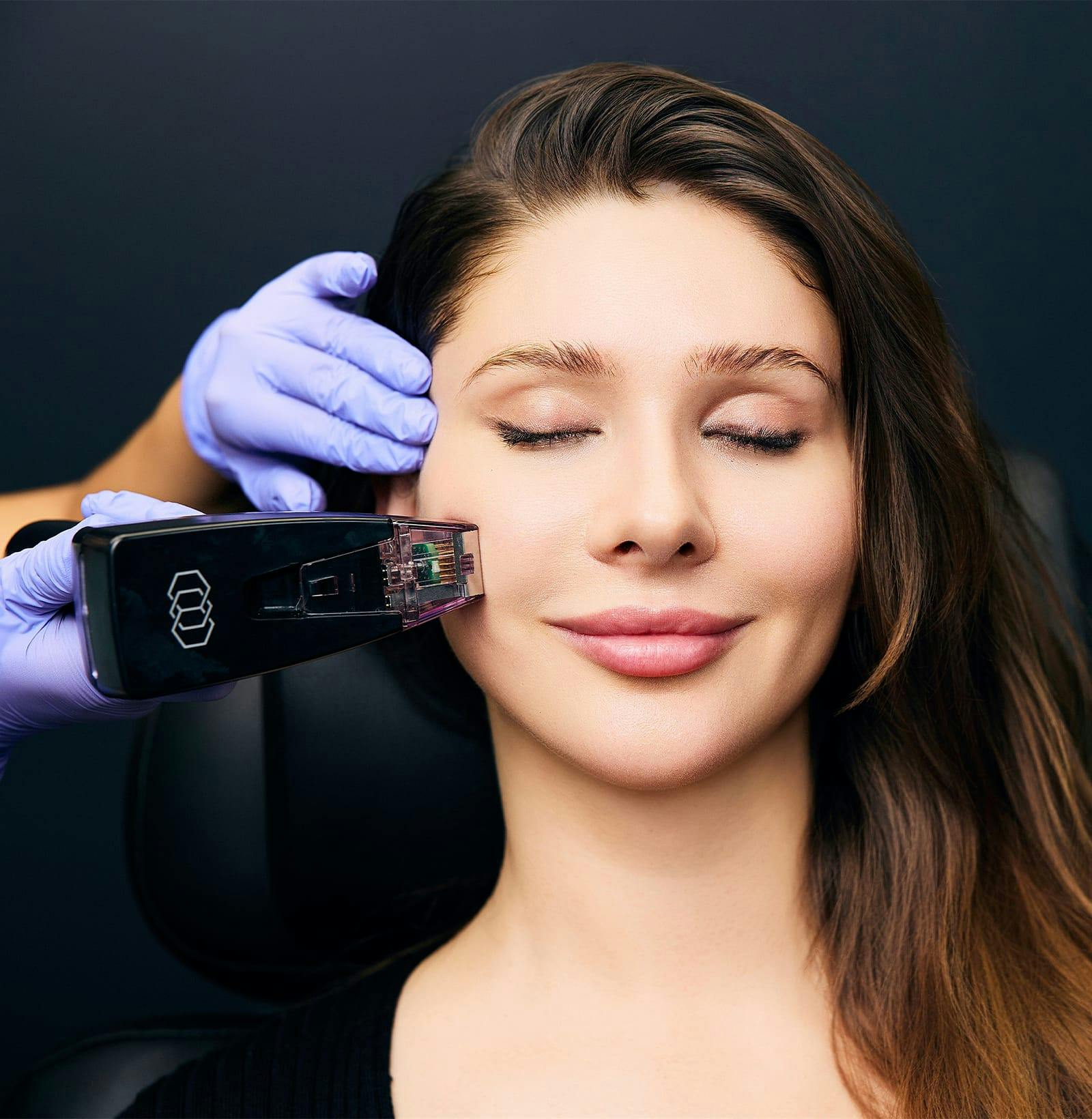 Is Morpheus8 the Right Solution for Your Skin Concerns?